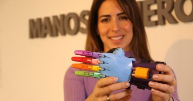 “Fue un antes y un después”: prótesis impresas en 3D están cambiando la vida de más de 100 amputados en Uruguay
