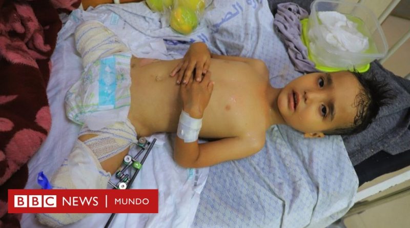 Israel - Hamás | Heridos y solos: los niños de Gaza que han quedado huérfanos - BBC News Mundo