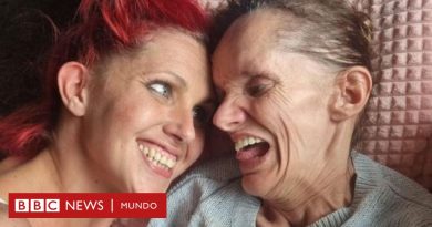 Neuroferritinopatía: la esperanza de una cura para 4 hermanas que viven atrapadas en sus cuerpos - BBC News Mundo