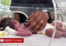 La bebé de Gaza que rescataron con vida del vientre de su madre muerta en un ataque de Israel - BBC News Mundo